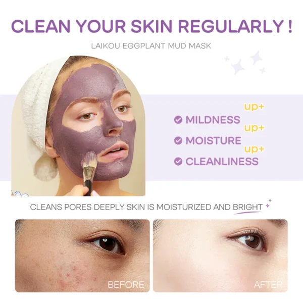 Eggplant Mud Mask – Oil Control 5pcs - Image 3
